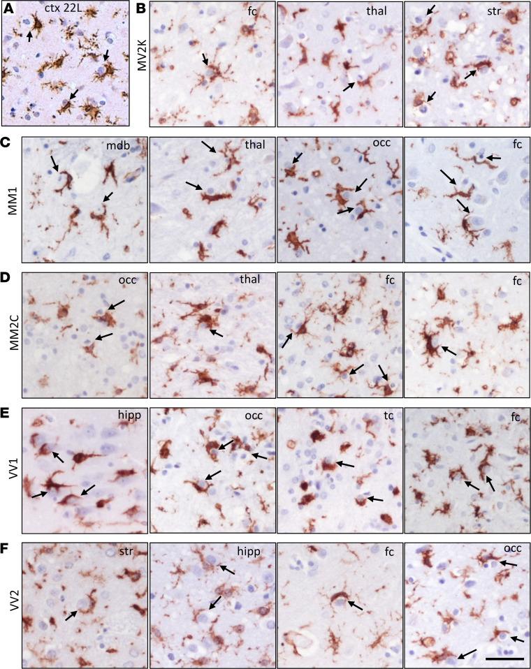 https://cdn.ncbi.nlm.nih.gov/pmc/blobs/8e4c/11601909/faf5c086ce8c/jci-134-181169-g026.jpg