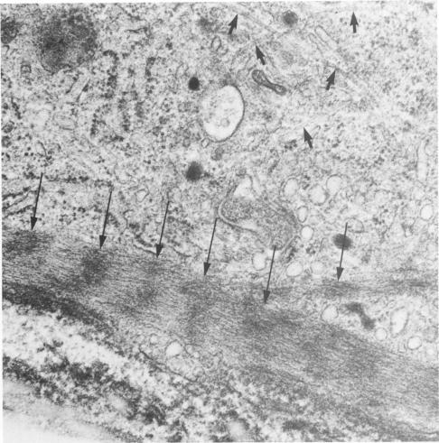 https://cdn.ncbi.nlm.nih.gov/pmc/blobs/8e52/2042438/7cd8074cd3e2/amjpathol00240-0069-a.jpg