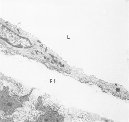 https://cdn.ncbi.nlm.nih.gov/pmc/blobs/8e52/2042438/8bee22e77471/amjpathol00240-0064-a.jpg