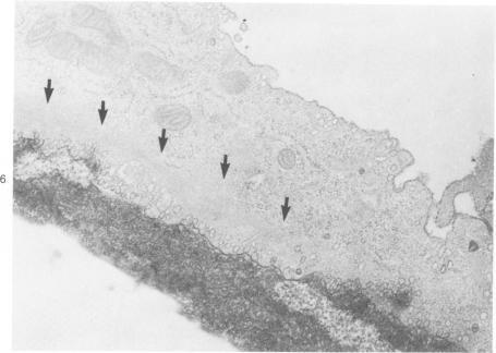 https://cdn.ncbi.nlm.nih.gov/pmc/blobs/8e52/2042438/e003e9348593/amjpathol00240-0066-a.jpg
