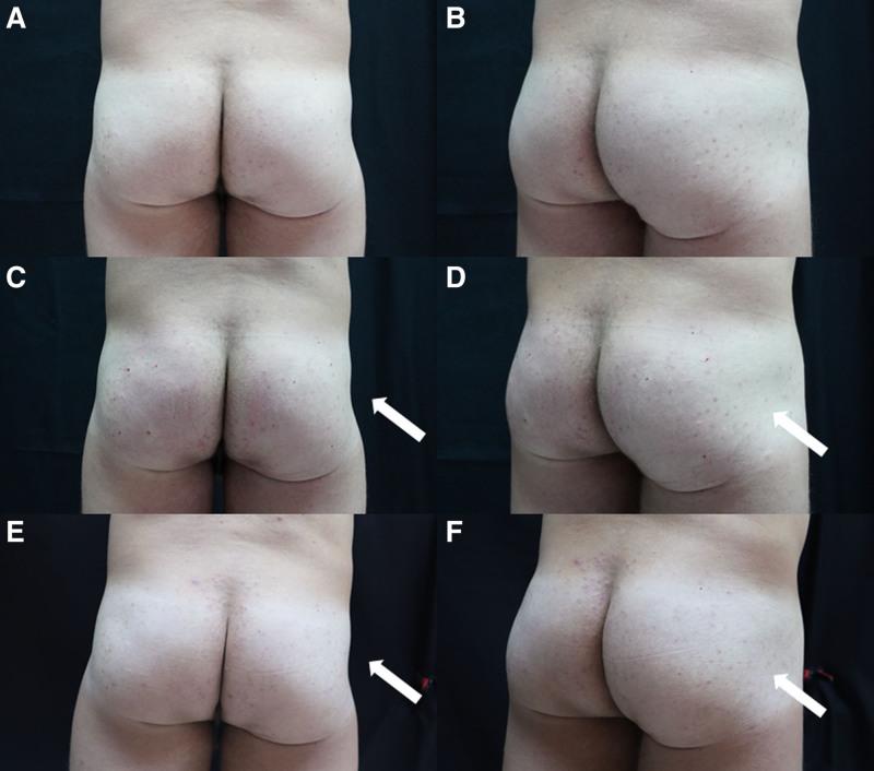 https://cdn.ncbi.nlm.nih.gov/pmc/blobs/8e5a/12055175/e101690c4447/gox-13-e6755-g006.jpg