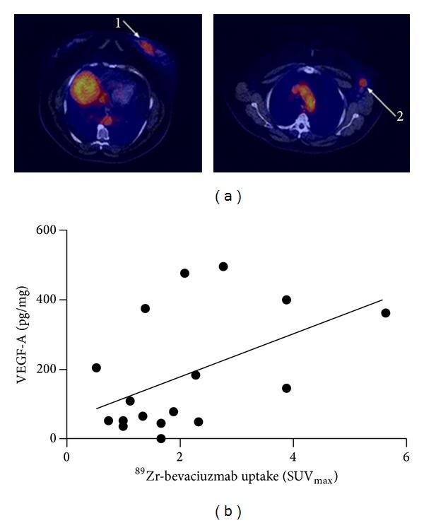 https://cdn.ncbi.nlm.nih.gov/pmc/blobs/8e5a/4058511/759f6c134b2c/BMRI2014-203601.005.jpg