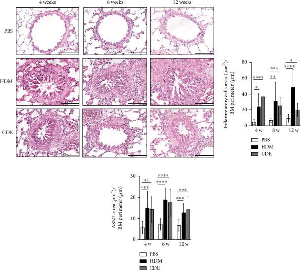 https://cdn.ncbi.nlm.nih.gov/pmc/blobs/8e5a/9904926/284a9487f373/JIR2023-9393497.002.jpg