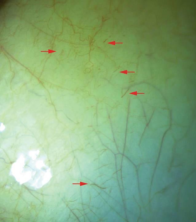 https://cdn.ncbi.nlm.nih.gov/pmc/blobs/8e5b/8492597/35ee9abb1e0a/347_2020_1319_Fig4_HTML.jpg