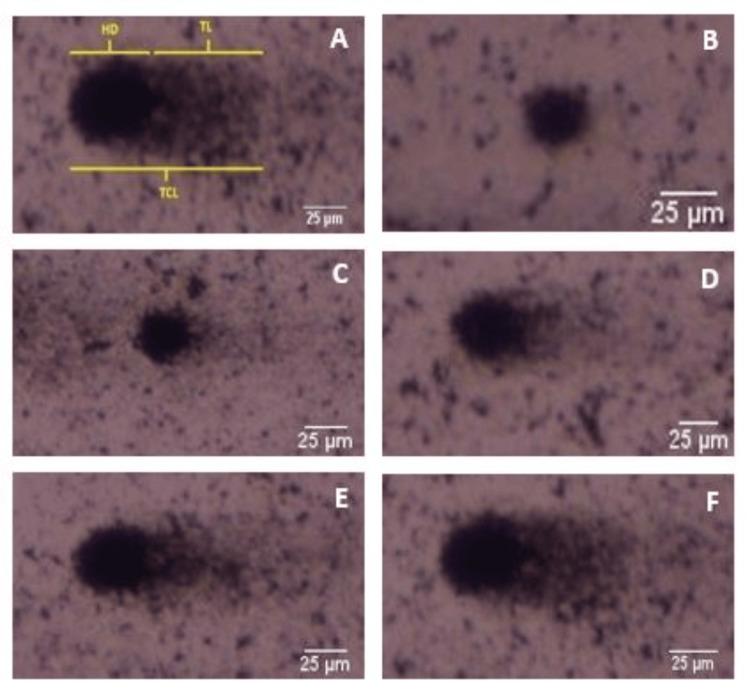 https://cdn.ncbi.nlm.nih.gov/pmc/blobs/8e5e/10875276/99ffc5ea8761/cureus-0016-00000052600-i03.jpg