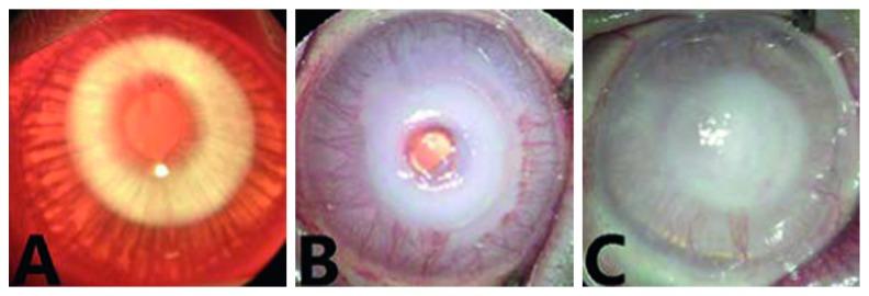 https://cdn.ncbi.nlm.nih.gov/pmc/blobs/8e5e/6198613/6f668116e023/JOPH2018-7325483.001.jpg