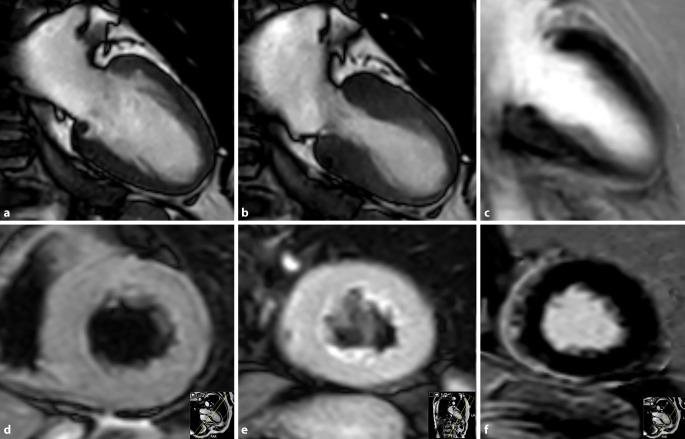 https://cdn.ncbi.nlm.nih.gov/pmc/blobs/8e5e/9613567/27a33ca5f92e/117_2022_1068_Fig10_HTML.jpg