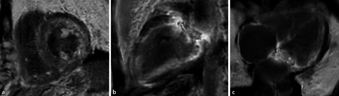 https://cdn.ncbi.nlm.nih.gov/pmc/blobs/8e5e/9613567/e4fe8b572fc4/117_2022_1068_Fig5_HTML.jpg