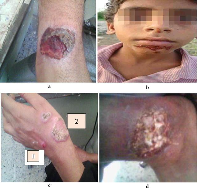 https://cdn.ncbi.nlm.nih.gov/pmc/blobs/8e5f/5496594/5a53aadc7246/12941_2017_224_Fig8_HTML.jpg
