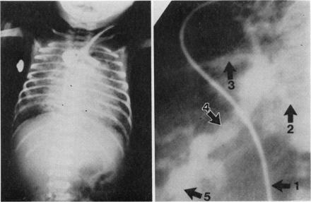 https://cdn.ncbi.nlm.nih.gov/pmc/blobs/8e62/1628347/81f80d30a059/archdisch00743-0069-a.jpg
