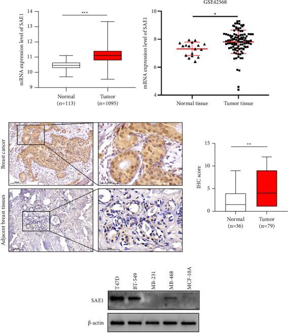 https://cdn.ncbi.nlm.nih.gov/pmc/blobs/8e67/11227943/45d3abf96389/TBJ2024-2981722.001.jpg