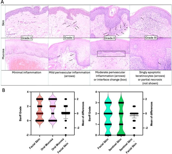 https://cdn.ncbi.nlm.nih.gov/pmc/blobs/8e67/11997448/8db8ea7b9208/fimmu-16-1562024-g001.jpg