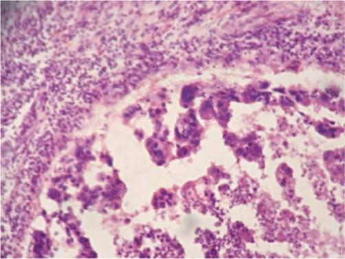 https://cdn.ncbi.nlm.nih.gov/pmc/blobs/8e68/3223956/bab1caec45c0/can-5-214f3.jpg