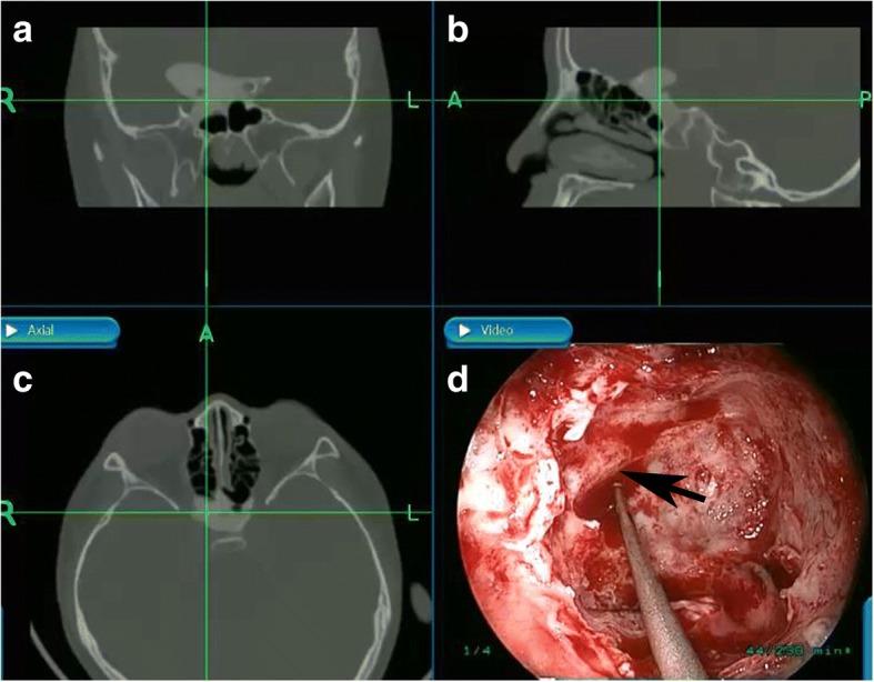 https://cdn.ncbi.nlm.nih.gov/pmc/blobs/8e68/6020208/ce248882122f/12886_2018_792_Fig2_HTML.jpg
