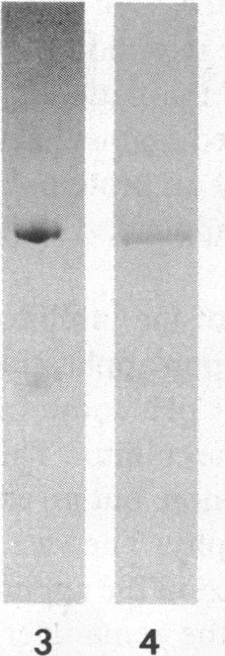 https://cdn.ncbi.nlm.nih.gov/pmc/blobs/8e6c/423360/397c2e22b7b5/jcinvest00105-0084-b.jpg