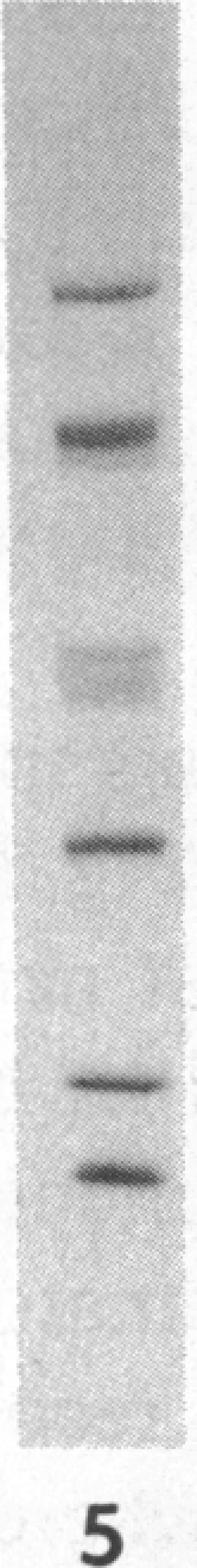 https://cdn.ncbi.nlm.nih.gov/pmc/blobs/8e6c/423360/cd2eeff624d6/jcinvest00105-0084-c.jpg