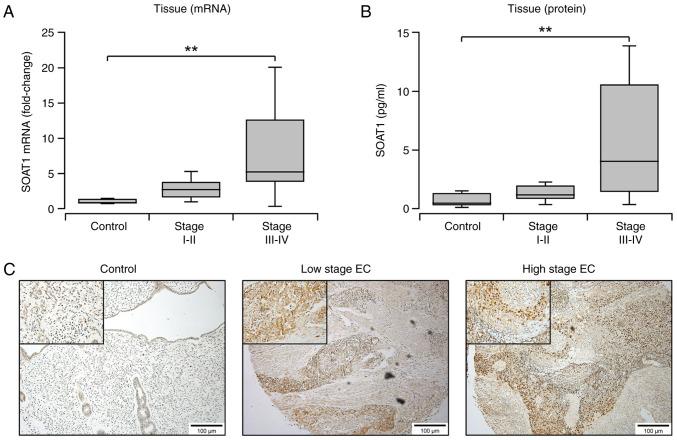https://cdn.ncbi.nlm.nih.gov/pmc/blobs/8e70/10157603/c817a34d4ed7/ol-25-06-13817-g00.jpg