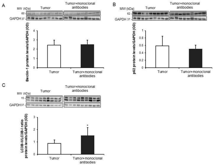 https://cdn.ncbi.nlm.nih.gov/pmc/blobs/8e70/6770046/eae68346b88d/cancers-11-01301-g007.jpg