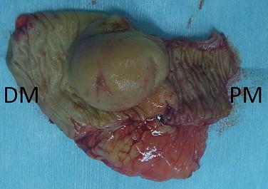 https://cdn.ncbi.nlm.nih.gov/pmc/blobs/8e71/4276274/2539d33847f3/gr2.jpg