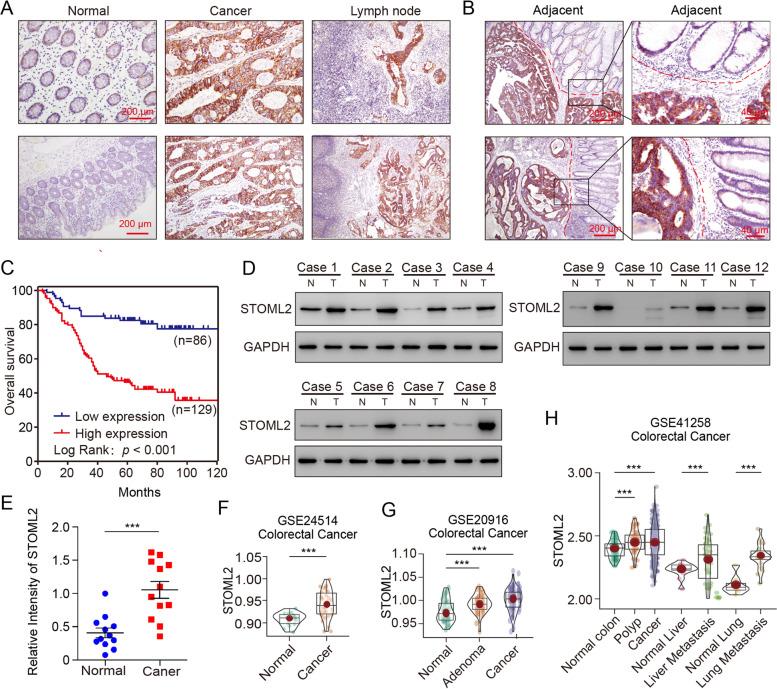 https://cdn.ncbi.nlm.nih.gov/pmc/blobs/8e76/8591804/49de7019c7b5/13046_2021_2116_Fig1_HTML.jpg
