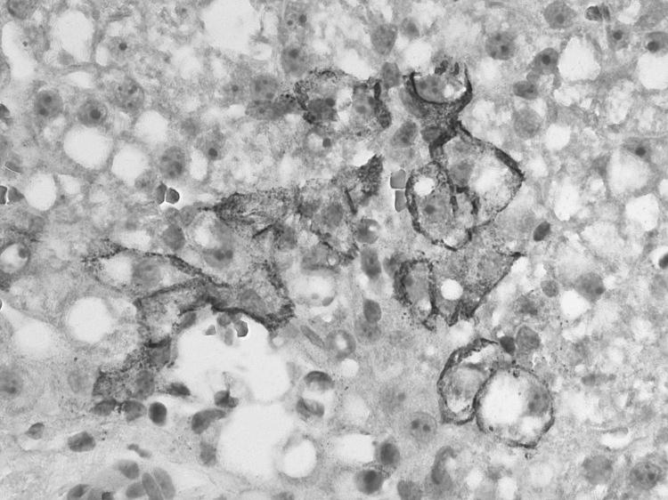 https://cdn.ncbi.nlm.nih.gov/pmc/blobs/8e7b/3414043/cee4cd4809a2/12-0212-F2.jpg