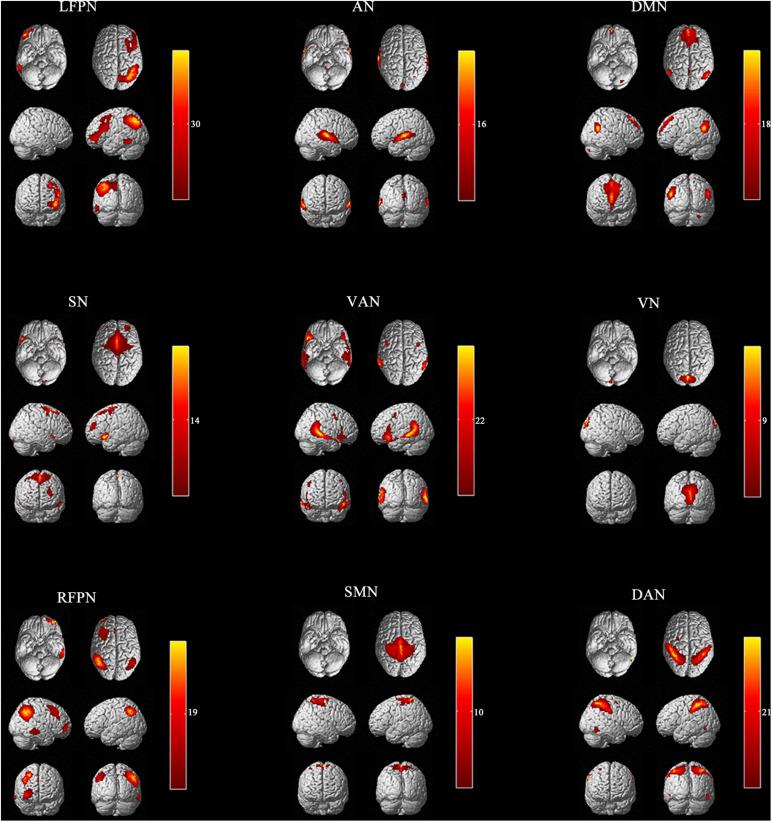 https://cdn.ncbi.nlm.nih.gov/pmc/blobs/8e7e/8551866/c355552e2014/fnhum-15-736512-g001.jpg