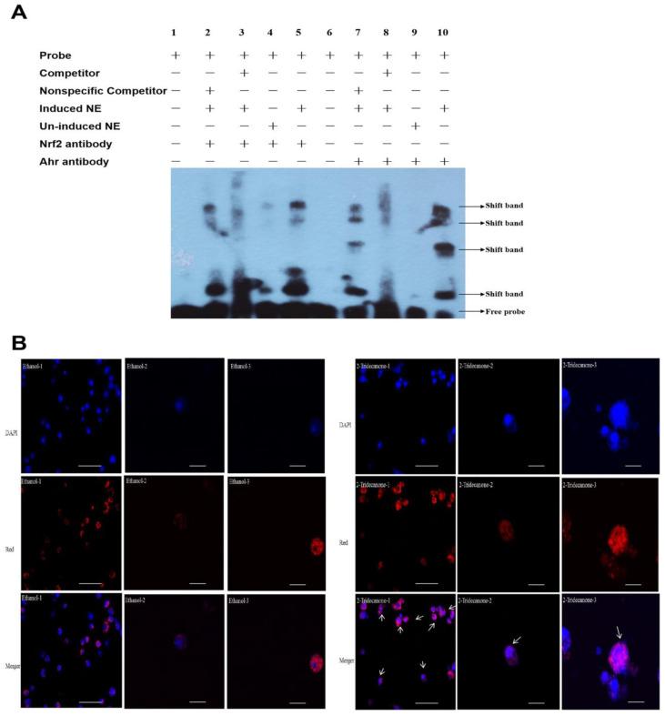 https://cdn.ncbi.nlm.nih.gov/pmc/blobs/8e7e/9788003/eeefe21a236a/ijms-23-16126-g007.jpg