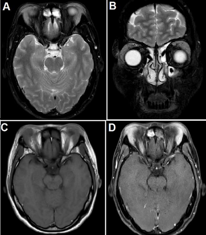 https://cdn.ncbi.nlm.nih.gov/pmc/blobs/8e80/7864275/f481d7201d5f/PAMJ-37-252-g004.jpg