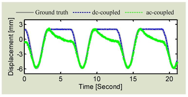 https://cdn.ncbi.nlm.nih.gov/pmc/blobs/8e81/5017335/cfd14f354b5d/sensors-16-01169-g010.jpg