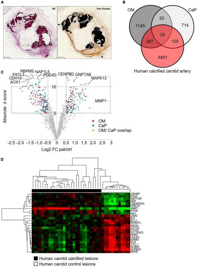 https://cdn.ncbi.nlm.nih.gov/pmc/blobs/8e85/9530266/63008f468861/fcvm-09-959457-g005.jpg