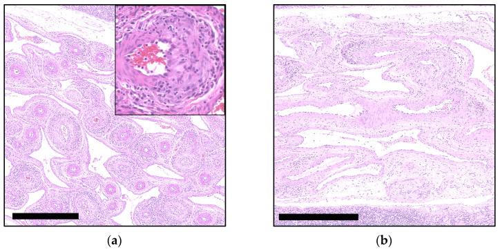 https://cdn.ncbi.nlm.nih.gov/pmc/blobs/8e8b/11437478/952eabcb8f57/viruses-16-01431-g002.jpg