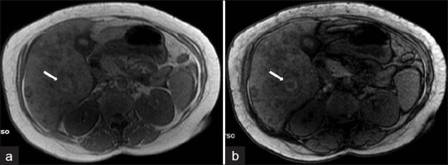 https://cdn.ncbi.nlm.nih.gov/pmc/blobs/8e8d/3279695/207d698ccf8e/JCIS-2-2-g017.jpg