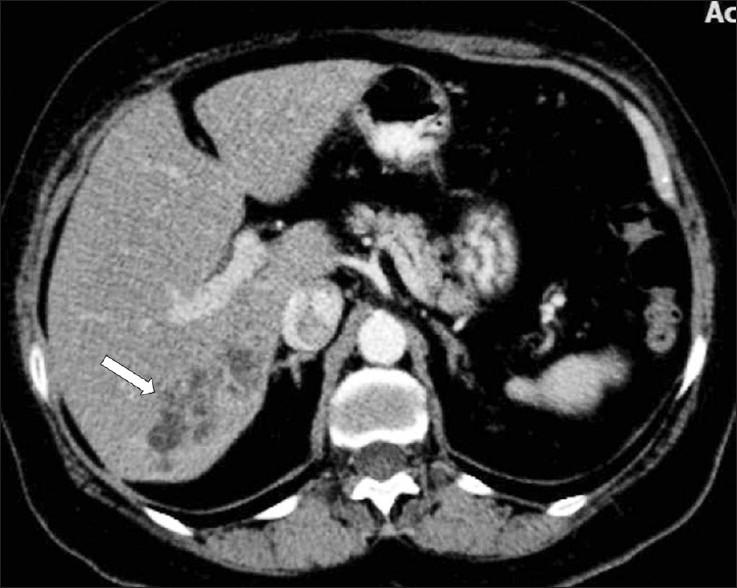 https://cdn.ncbi.nlm.nih.gov/pmc/blobs/8e8d/3279695/50f60f3692d5/JCIS-2-2-g008.jpg