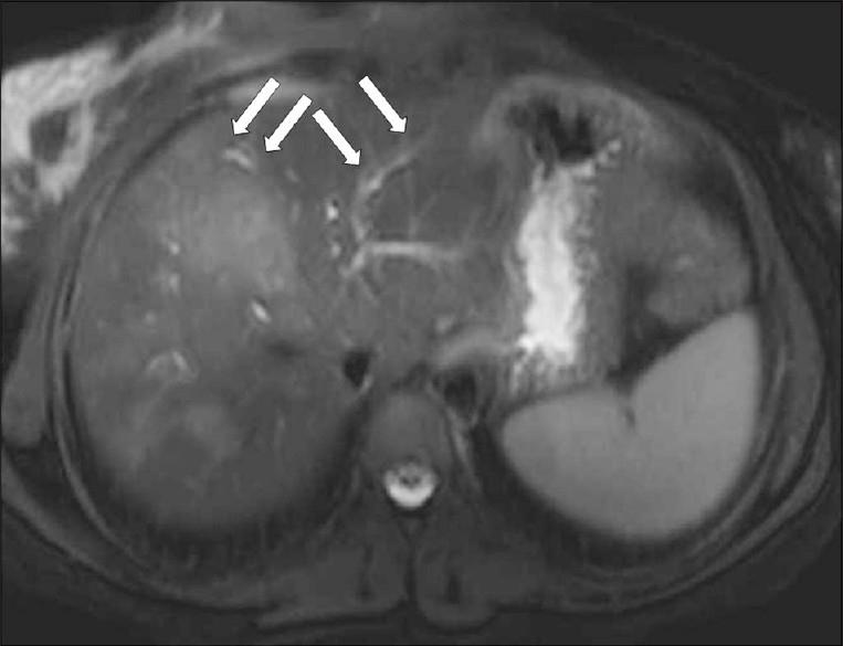 https://cdn.ncbi.nlm.nih.gov/pmc/blobs/8e8d/3279695/67a087d5398d/JCIS-2-2-g014.jpg