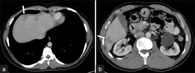 https://cdn.ncbi.nlm.nih.gov/pmc/blobs/8e8d/3279695/cb65810c6ea1/JCIS-2-2-g009.jpg
