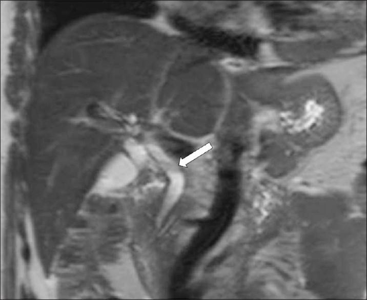https://cdn.ncbi.nlm.nih.gov/pmc/blobs/8e8d/3279695/ff59196e1d54/JCIS-2-2-g015.jpg