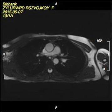 https://cdn.ncbi.nlm.nih.gov/pmc/blobs/8e8d/4736703/7f0240bf3458/12968_2016_227_Fig2_HTML.jpg