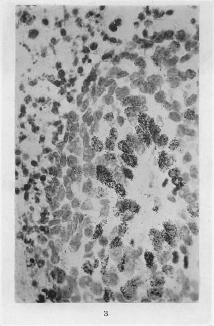 https://cdn.ncbi.nlm.nih.gov/pmc/blobs/8e90/2008239/362dafc9ead0/brjcancer00475-0109-a.jpg