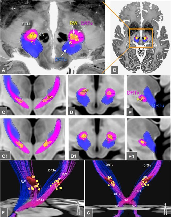 https://cdn.ncbi.nlm.nih.gov/pmc/blobs/8e94/12305315/adb224d36daf/gr5.jpg
