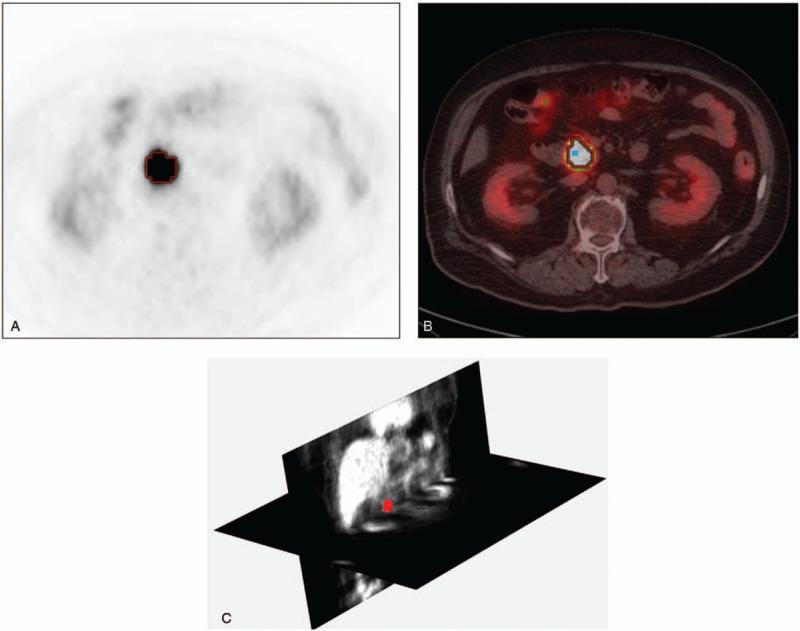https://cdn.ncbi.nlm.nih.gov/pmc/blobs/8e95/7458160/614791416834/medi-99-e21829-g001.jpg