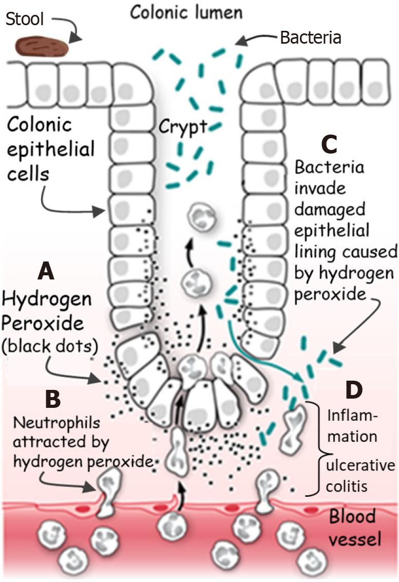 https://cdn.ncbi.nlm.nih.gov/pmc/blobs/8eac/12264756/623022a918db/wjg-31-26-108375-g004.jpg