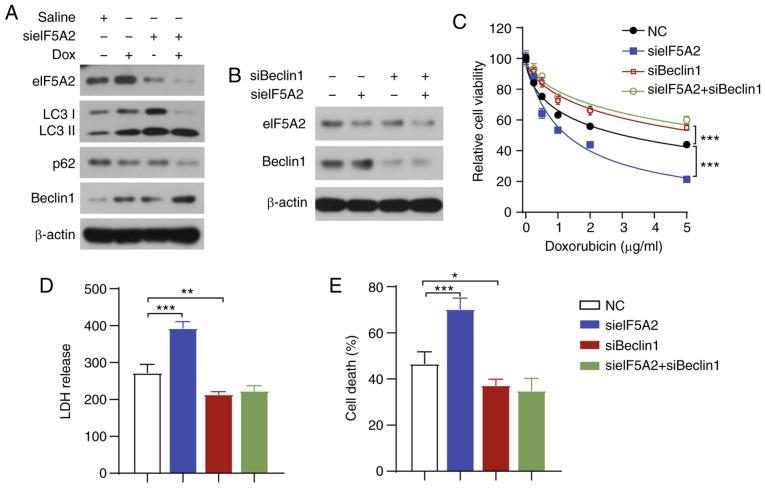 https://cdn.ncbi.nlm.nih.gov/pmc/blobs/8eae/7646588/b8082ec272b5/IJO-57-06-1368-g05.jpg
