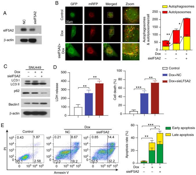 https://cdn.ncbi.nlm.nih.gov/pmc/blobs/8eae/7646588/ca4e6b1ad54e/IJO-57-06-1368-g03.jpg