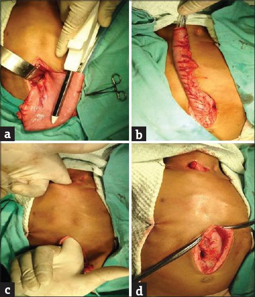 https://cdn.ncbi.nlm.nih.gov/pmc/blobs/8eb8/11968038/b7620e532364/JIAPS-30-177-g002.jpg