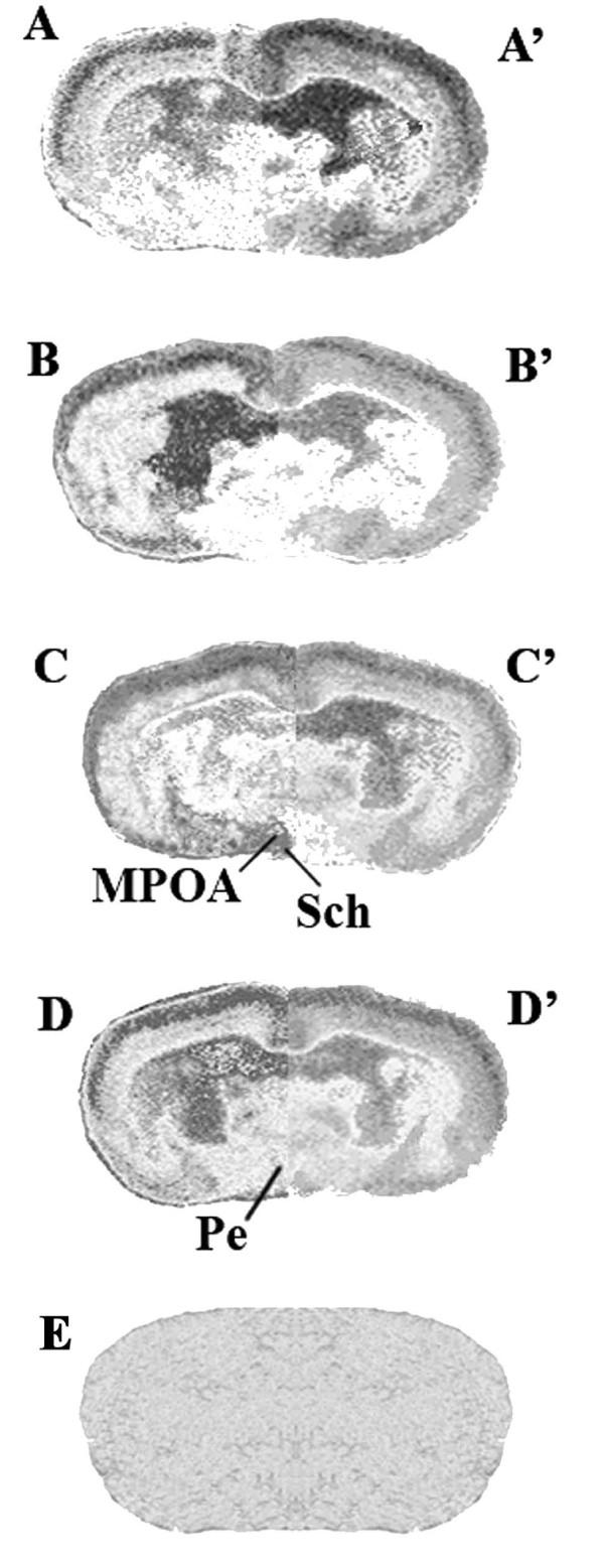 https://cdn.ncbi.nlm.nih.gov/pmc/blobs/8eba/2944354/d211d8bdf23f/1471-2202-11-111-2.jpg