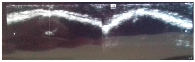 https://cdn.ncbi.nlm.nih.gov/pmc/blobs/8ebf/10887665/2e0318bff3e1/diagnostics-14-00435-g002.jpg