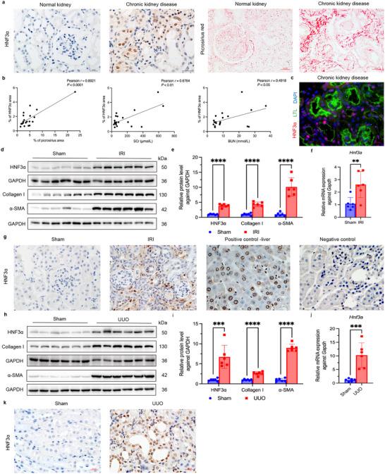 https://cdn.ncbi.nlm.nih.gov/pmc/blobs/8ec2/12097113/469e25509977/ADVS-12-2410764-g002.jpg