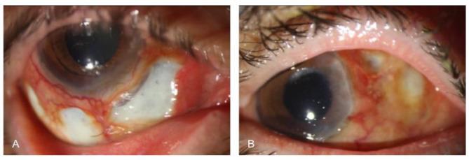 https://cdn.ncbi.nlm.nih.gov/pmc/blobs/8ec3/11974155/1966156cd225/12886_2025_4027_Fig1_HTML.jpg