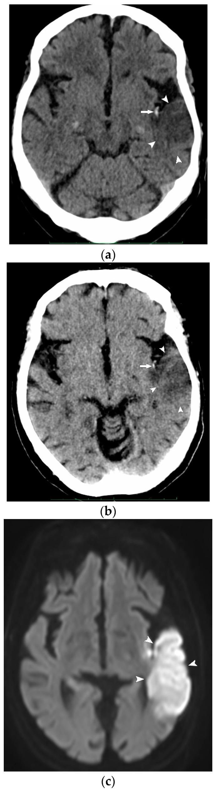 https://cdn.ncbi.nlm.nih.gov/pmc/blobs/8ec7/11242297/aead51c18401/jcm-13-03647-g002.jpg