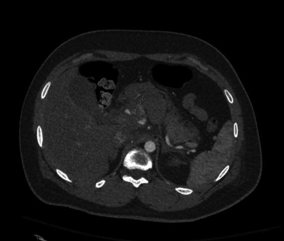 https://cdn.ncbi.nlm.nih.gov/pmc/blobs/8ec9/9020312/edf8298a0791/tsaco-2022-000909f02.jpg